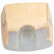 ILMANSUODATIN, HUOPA - Husqvarna varaosat - 522675003 - 2